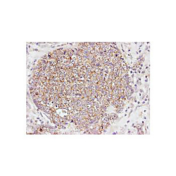 Anti-AKT pS473 (RABBIT) Antibody, 25µL, Liquid (sterile filtered)