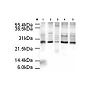 APC10 nterm Antibody 100µg
