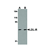 Anti-LDL-R (CHICKEN) Antibody, 100µg, Liquid (sterile filtered)