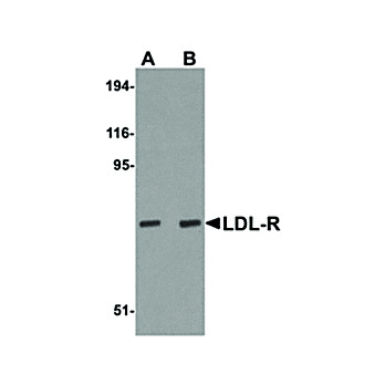 Anti-LDL-R (CHICKEN) Antibody, 100µg, Liquid (sterile filtered)