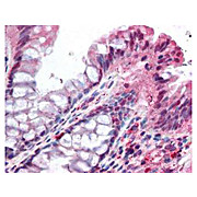Anti-NOXO1 (RABBIT) Antibody, 100µg, Liquid (sterile filtered)