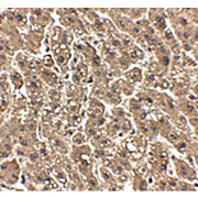 Anti-erbB-2 (CHICKEN) Antibody, 100µg, Liquid (sterile filtered)