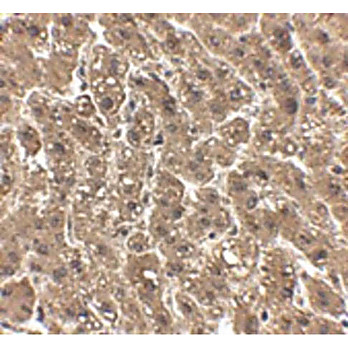 Anti-erbB-2 (CHICKEN) Antibody, 100µg, Liquid (sterile filtered)