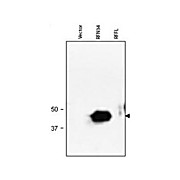 Anti-RNF34 (RABBIT) Antibody, 500µg, Lyophilized