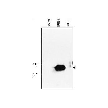 Anti-RNF34 (RABBIT) Antibody, 500µg, Lyophilized