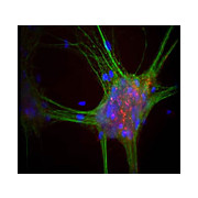 Anti-Alpha Synuclein (Mouse) Antibody, 100µL, Liquid