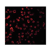 Anti-TLR11 (RABBIT) Antibody, 100µg, Liquid (sterile filtered)