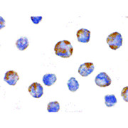Anti-NALP1 (RABBIT) Antibody, 100µg, Liquid (sterile filtered)