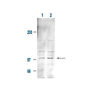 Anti-MDM2 pS185 (RABBIT) Antibody, 100µg, Liquid (sterile filtered)