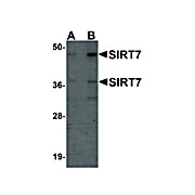 Anti-SIRT7 (CHICKEN) Antibody, 100µg, Liquid (sterile filtered)