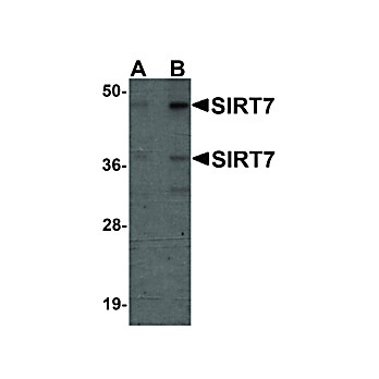 Anti-SIRT7 (CHICKEN) Antibody, 100µg, Liquid (sterile filtered)