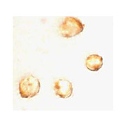 Survivin Antibody hu cterm 100µg