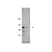 Anti-BORIS (RABBIT) Antibody, 100µg, Liquid (sterile filtered)