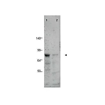 Anti-BORIS (RABBIT) Antibody, 100µg, Liquid (sterile filtered)