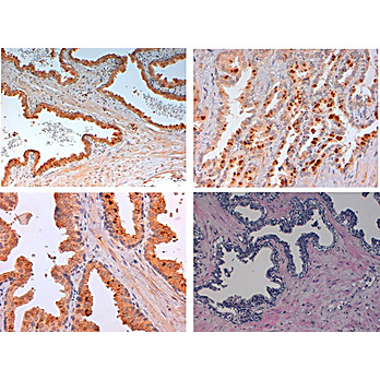 Anti-SLIT-2 (RABBIT) Antibody, 100µg, Liquid (sterile filtered)