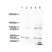Anti-SmarcAL1 (RABBIT) Antibody, 100µg, Liquid (sterile filtered)