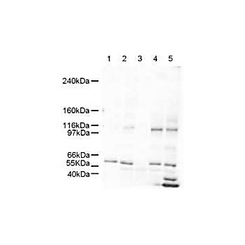 Anti-SmarcAL1 (RABBIT) Antibody, 100µg, Liquid (sterile filtered)
