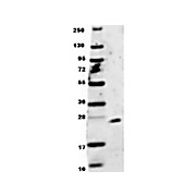 Anti-Human EBI-3 (RABBIT) Antibody, 100µg, Lyophilized