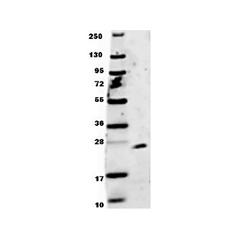 Anti-Human EBI-3 (RABBIT) Antibody, 100µg, Lyophilized