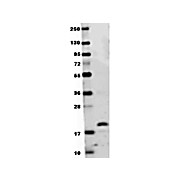 Anti-Mouse RANK-L (RABBIT) Antibody, 100µg, Lyophilized