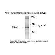 Anti-Thyroid Hormone Receptor alpha 2 (Mouse) Monoclonal Antibody, 100µL, Liquid