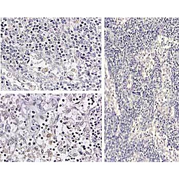 Anti-Human IL-1ß (RABBIT) Antibody, 1mg, Liquid (sterile filtered)