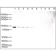 Anti-HAUSP (RABBIT) Antibody, 100µg, Liquid (sterile filtered)