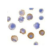 Anti-IRAK (RABBIT) Antibody, 100µg, Liquid (sterile filtered)