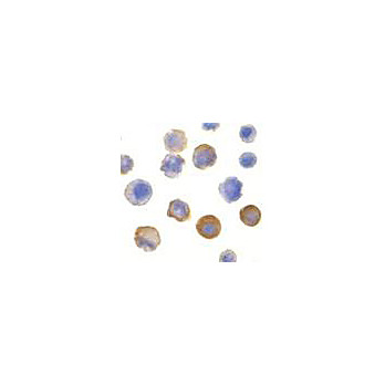 Anti-IRAK (RABBIT) Antibody, 100µg, Liquid (sterile filtered)