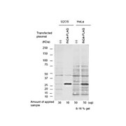 Anti-p29 ING4 (GOAT) Antibody, 100µg, Liquid (sterile filtered)