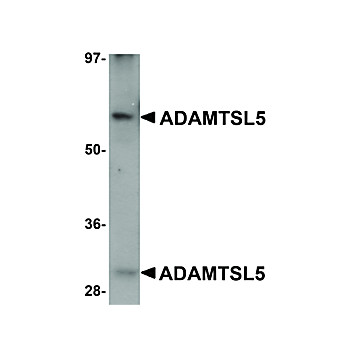 Anti-ADAMTSL5 (CHICKEN) Antibody, 100µg, Liquid (sterile filtered)