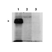 Anti-MLF1 Interacting Protein (internal) (RABBIT) Antibody, 100µg, Liquid (sterile filtered)