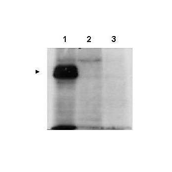 Anti-MLF1 Interacting Protein (internal) (RABBIT) Antibody, 100µg, Liquid (sterile filtered)