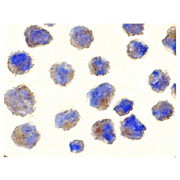 Anti-BACE (RABBIT) Antibody, 100µg, Liquid (sterile filtered)