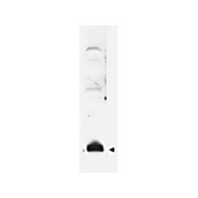 Anti-SUMO (RABBIT) Antibody, 500µg, Lyophilized
