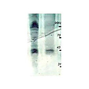 Anti-PhosphoThreonine (pT) [RABBIT] Antibody, 100µg, Liquid (sterile filtered)