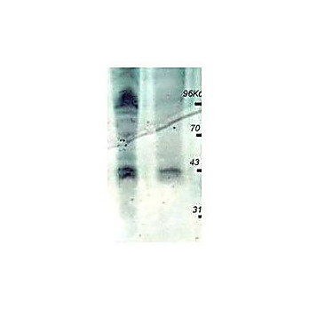 Anti-PhosphoThreonine (pT) [RABBIT] Antibody, 100µg, Liquid (sterile filtered)