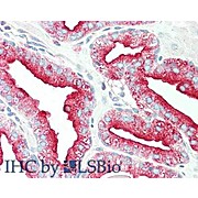 Anti-TMBIM1 (RABBIT) Antibody, 100µg, Liquid (sterile filtered)