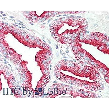 Anti-TMBIM1 (RABBIT) Antibody, 100µg, Liquid (sterile filtered)