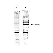 Anti-Human RAD52 (RABBIT) Antibody, 100µg, Liquid (sterile filtered)