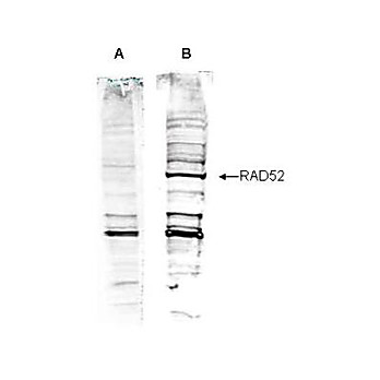 Anti-Human RAD52 (RABBIT) Antibody, 100µg, Liquid (sterile filtered)