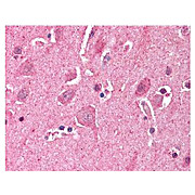 Anti-LDB2 (CLIM1) (RABBIT) Antibody, 100µg, Liquid (sterile filtered)