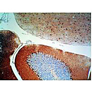 Anti-S100 Protein (RABBIT) Antibody, 500µg, Lyophilized