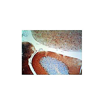 Anti-S100 Protein (RABBIT) Antibody, 500µg, Lyophilized