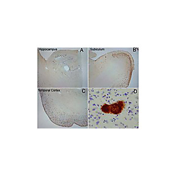 Anti-Amyloid Fibrils (OC) (RABBIT) Antibody, 100µL, Liquid (sterile filtered)