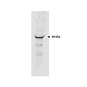 Anti-MAPKAP Kinase 2 (RABBIT) Antibody, 100µg, Liquid (sterile filtered)
