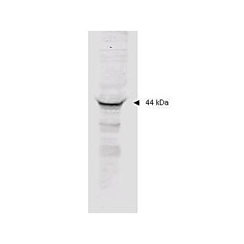 Anti-MAPKAP Kinase 2 (RABBIT) Antibody, 100µg, Liquid (sterile filtered)
