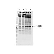 Anti-NF2 (Merlin) pS518 (RABBIT) Antibody, 100µg, Liquid (sterile filtered)
