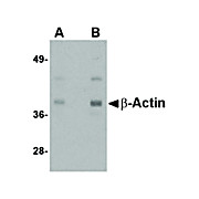 Beta Actin nterm Antibody 100µg