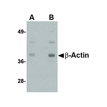Beta Actin nterm Antibody 100µg